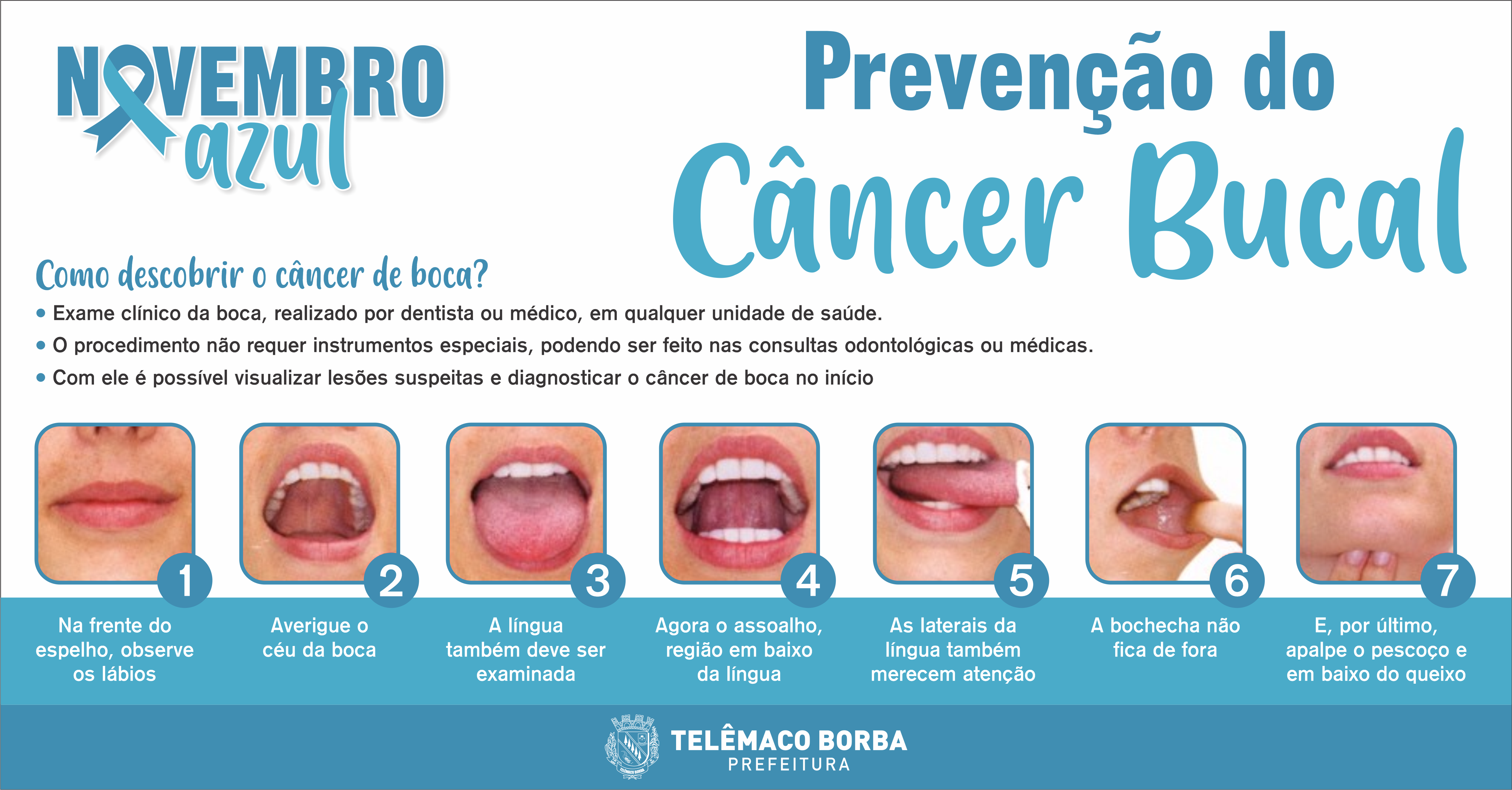 cancer bucal como prevenir